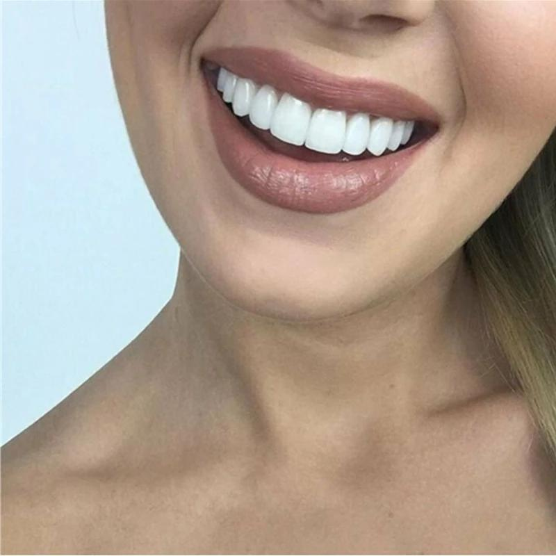 BrightDent SnapFit – Elegant and Comfortable Denture for a Radiant Smile