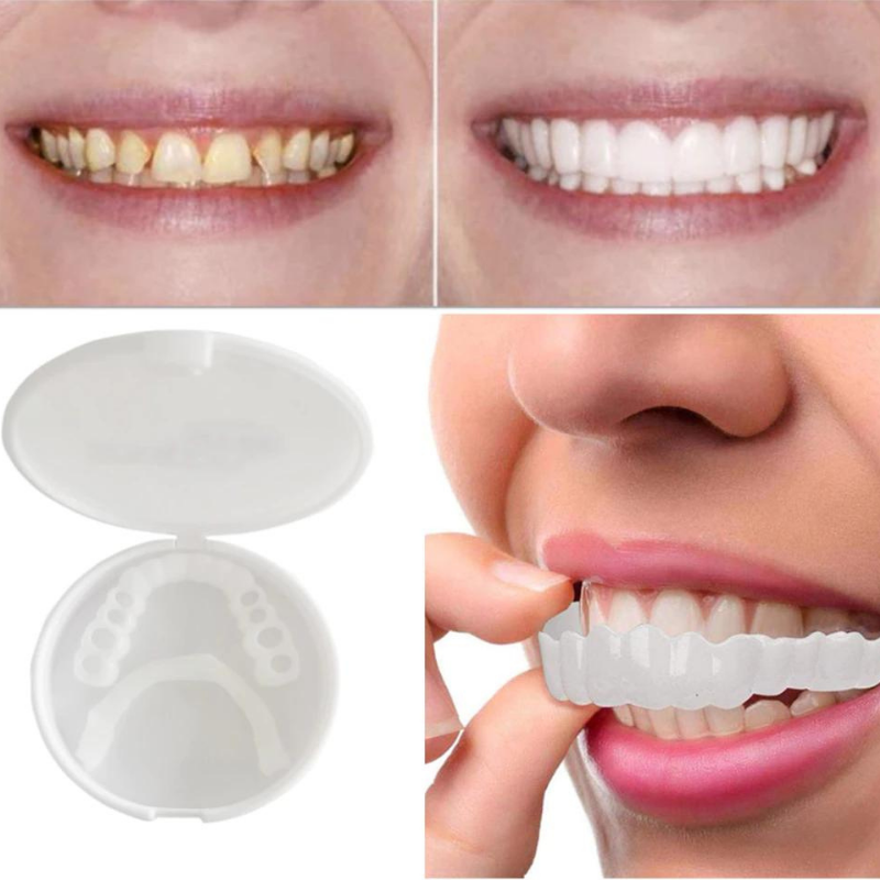 BrightDent SnapFit – Elegant and Comfortable Denture for a Radiant Smile
